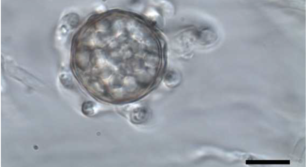ピシウム アレノマネスの造卵器と造精器（造卵器の周りに7個以上の造精器が付着